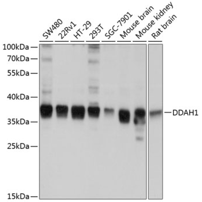 DDAH1 Rabbit Polyclonal Antibody