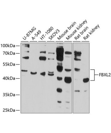 FBXL2 Rabbit Polyclonal Antibody