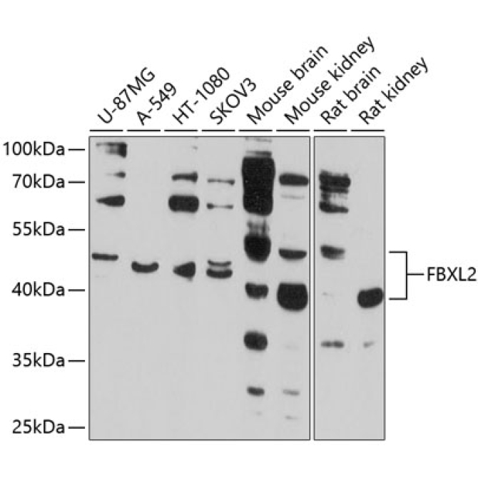 FBXL2 Rabbit Polyclonal Antibody