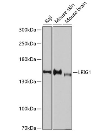 LRIG1 Rabbit Polyclonal Antibody