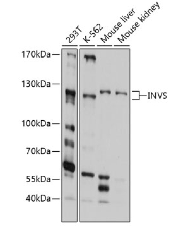 INVS Rabbit Polyclonal Antibody