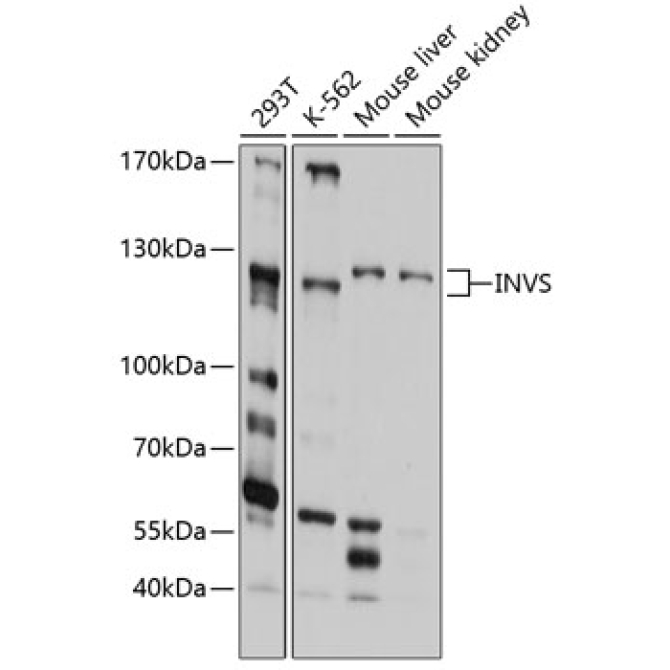 INVS Rabbit Polyclonal Antibody