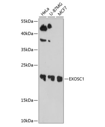 EXOSC1 Rabbit Polyclonal Antibody