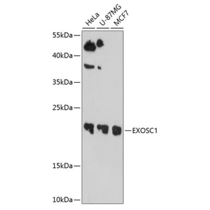 EXOSC1 Rabbit Polyclonal Antibody