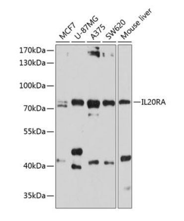 IL20RA Rabbit Polyclonal Antibody