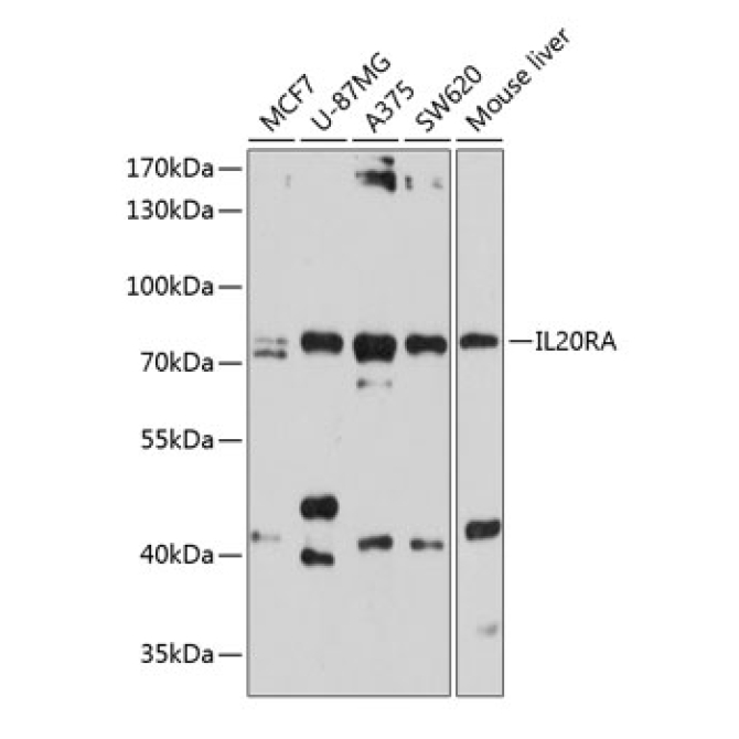 IL20RA Rabbit Polyclonal Antibody