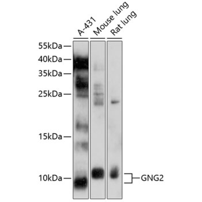 GNG2 Rabbit Polyclonal Antibody