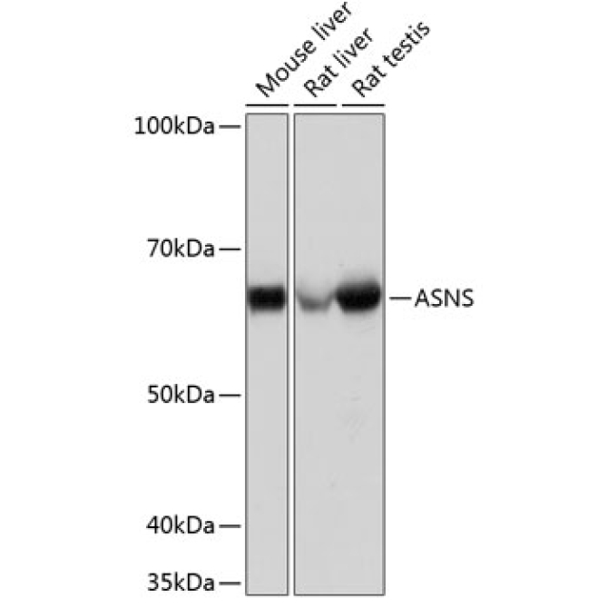 ASNS Rabbit Monoclonal Antibody