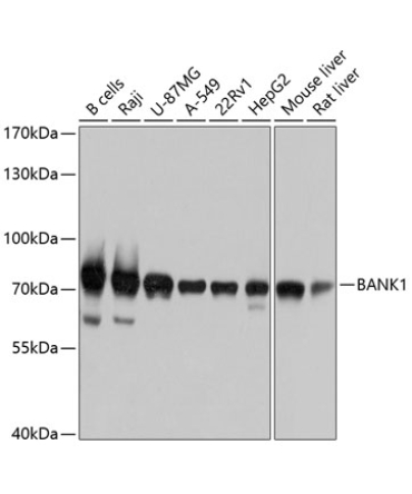 BANK1 Rabbit Polyclonal Antibody
