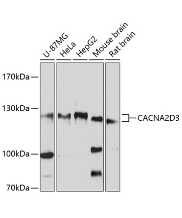 CACNA2D3 Rabbit Polyclonal Antibody