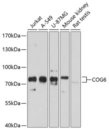 COG6 Rabbit Polyclonal Antibody