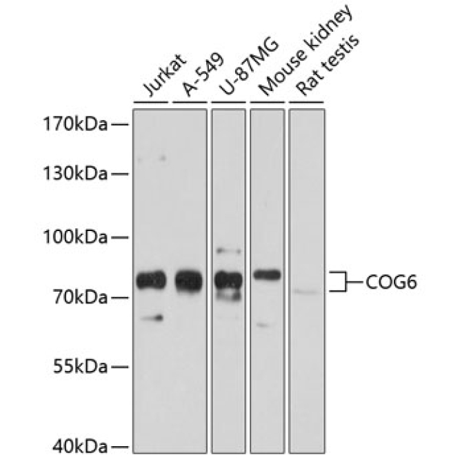 COG6 Rabbit Polyclonal Antibody