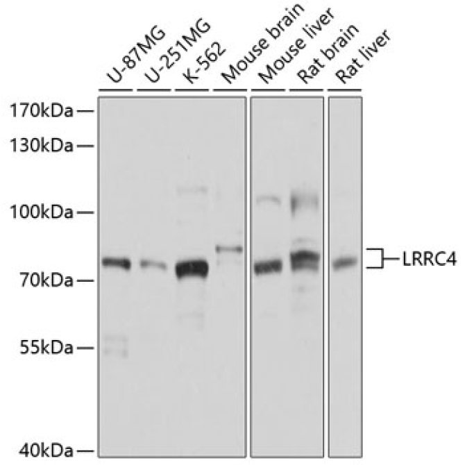 LRRC4 Rabbit Polyclonal Antibody