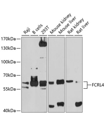 FCRL4 Rabbit Polyclonal Antibody