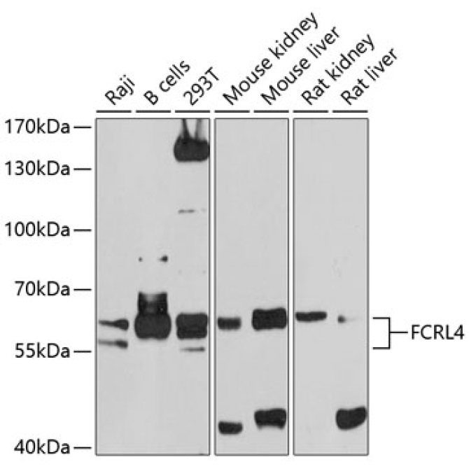 FCRL4 Rabbit Polyclonal Antibody