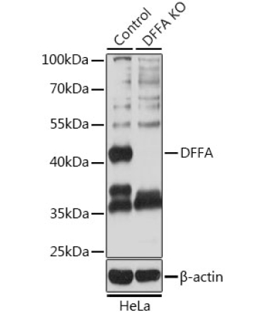 DFFA Rabbit Polyclonal Antibody [KO Validated]