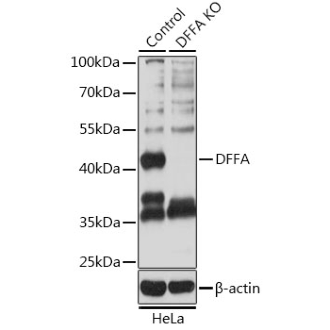DFFA Rabbit Polyclonal Antibody [KO Validated]