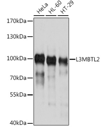 L3MBTL2 Rabbit Polyclonal Antibody