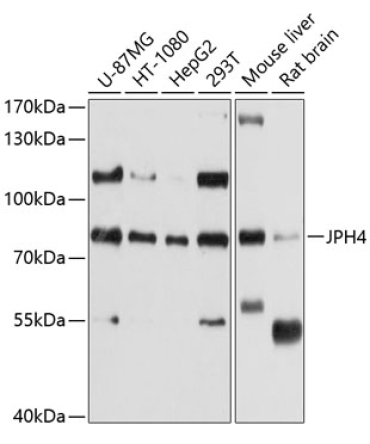 JPH4 Rabbit Polyclonal Antibody