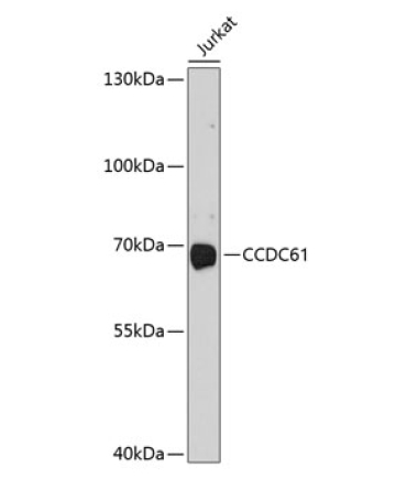 CCDC61 Rabbit Polyclonal Antibody