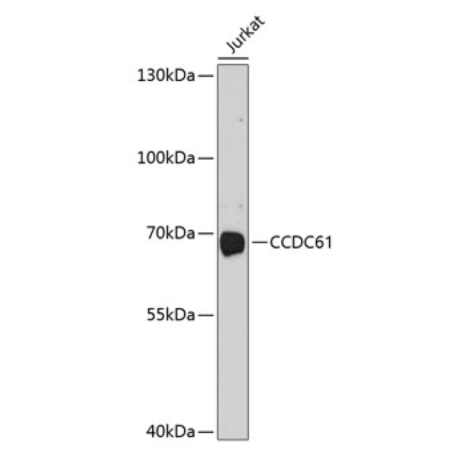 CCDC61 Rabbit Polyclonal Antibody