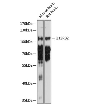 IL12RB2 Rabbit Polyclonal Antibody