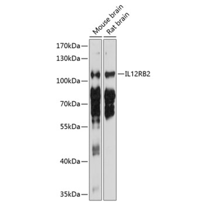 IL12RB2 Rabbit Polyclonal Antibody