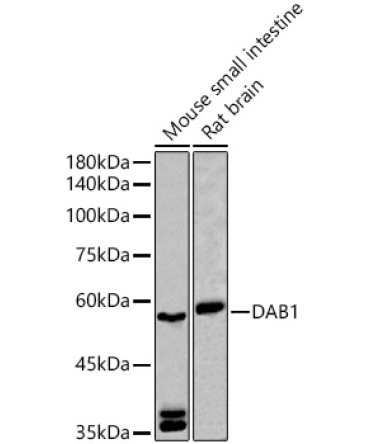 DAB1 Rabbit Polyclonal Antibody