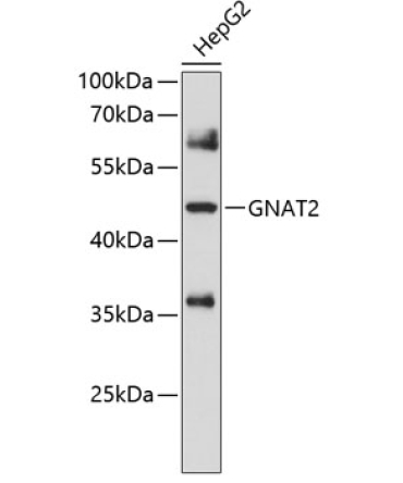 GNAT2 Rabbit Polyclonal Antibody