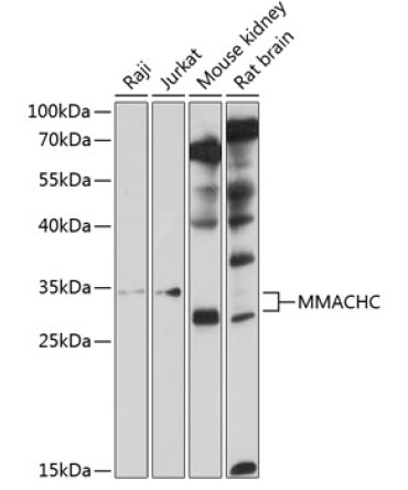 MMACHC Rabbit Polyclonal Antibody