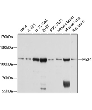 MZF1 Rabbit Polyclonal Antibody
