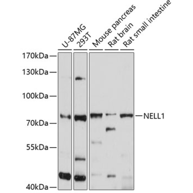 NELL1 Rabbit Polyclonal Antibody