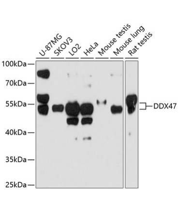 DDX47 Rabbit Polyclonal Antibody
