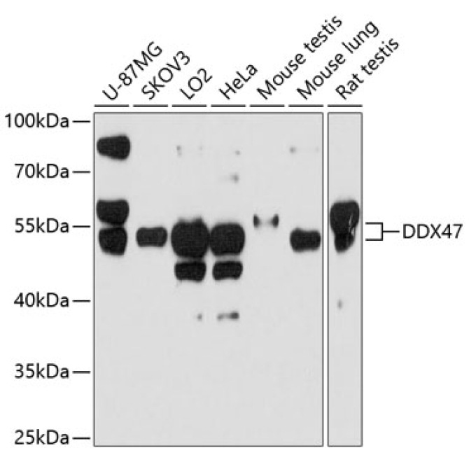 DDX47 Rabbit Polyclonal Antibody