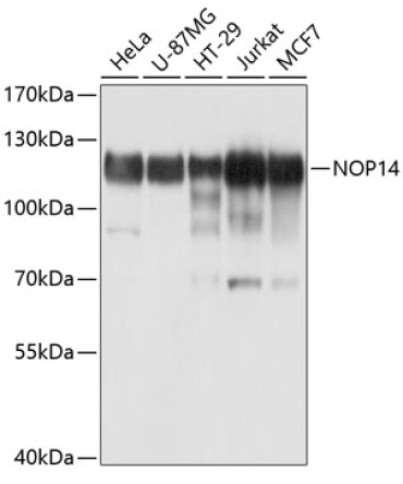 NOP14 Rabbit Polyclonal Antibody