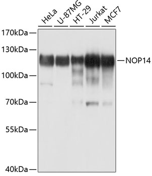 NOP14 Rabbit Polyclonal Antibody
