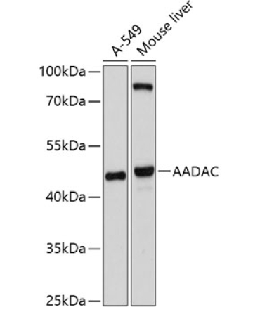 AADAC Rabbit Polyclonal Antibody