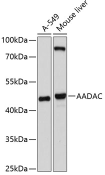 AADAC Rabbit Polyclonal Antibody