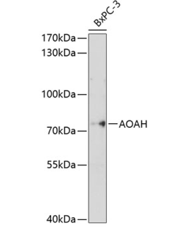 AOAH Rabbit Polyclonal Antibody