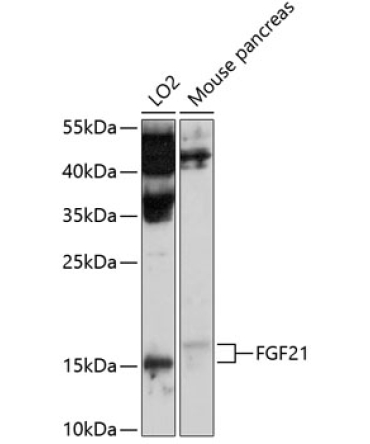 FGF21 Rabbit Polyclonal Antibody