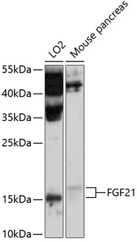 FGF21 Rabbit Polyclonal Antibody