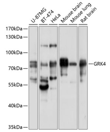 GRK4 Rabbit Polyclonal Antibody