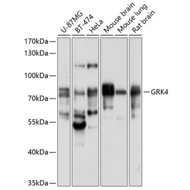GRK4 Rabbit Polyclonal Antibody