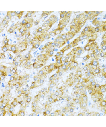 KLHL42 Rabbit Polyclonal Antibody