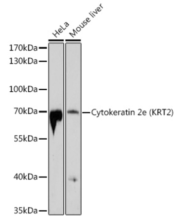 Cytokeratin 2e (KRT2) Rabbit Polyclonal Antibody