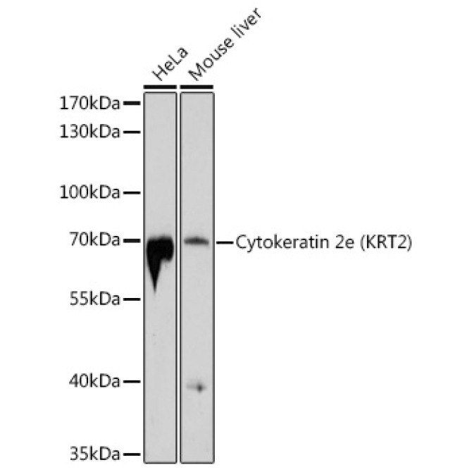 Cytokeratin 2e (KRT2) Rabbit Polyclonal Antibody