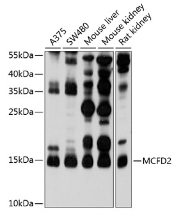MCFD2 Rabbit Polyclonal Antibody