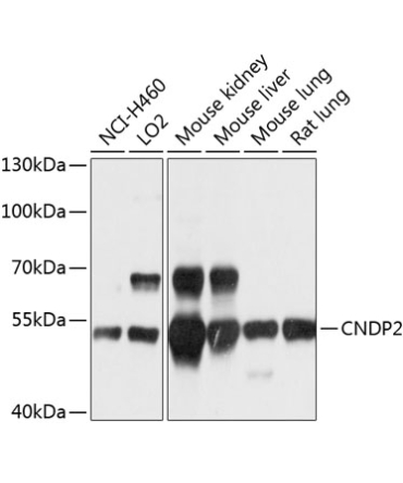 CNDP2 Rabbit Polyclonal Antibody