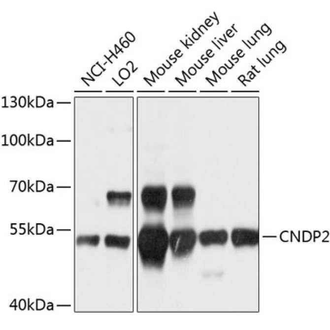 CNDP2 Rabbit Polyclonal Antibody