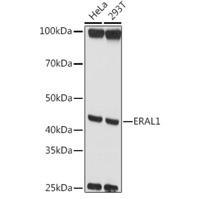 ERAL1 Rabbit Polyclonal Antibody